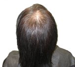 hair replacement systems California, Hair Replacement, Hair Extensions, Hair Integration, Hair Systems, Yuko Thermal Reconditioning